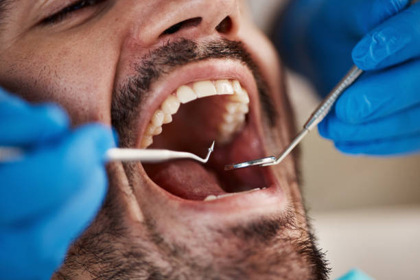 Best Weekend Emergency Dentist in Black Diamond, FL