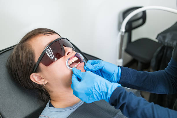 Best Emergency Tooth Extraction in Black Diamond, FL