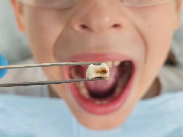 Best Emergency Orthodontic Repairs in Black Diamond, FL